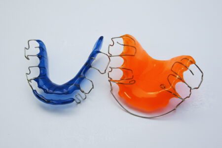 Aktive Platten – lose Zahnspangen für Kinder und Jugendliche bei Skyline Kieferorthopädie Frankfurt am Main im Europaviertel. Sanfte Zahnkorrektur mit modernen, individuell gefertigten Spangen – direkt an der Europa-Allee nahe Skyline Plaza.