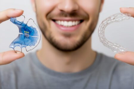 Retentionsspangen und Halteschienen nach der Zahnkorrektur – Skyline Kieferorthopädie Frankfurt am Main, Europaviertel, nahe Skyline Plaza. Dauerhafte Stabilisierung nach Aligner- oder Spangenbehandlung.